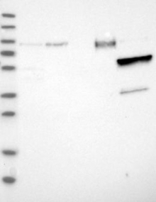 NBP1-85576 - MMP-8